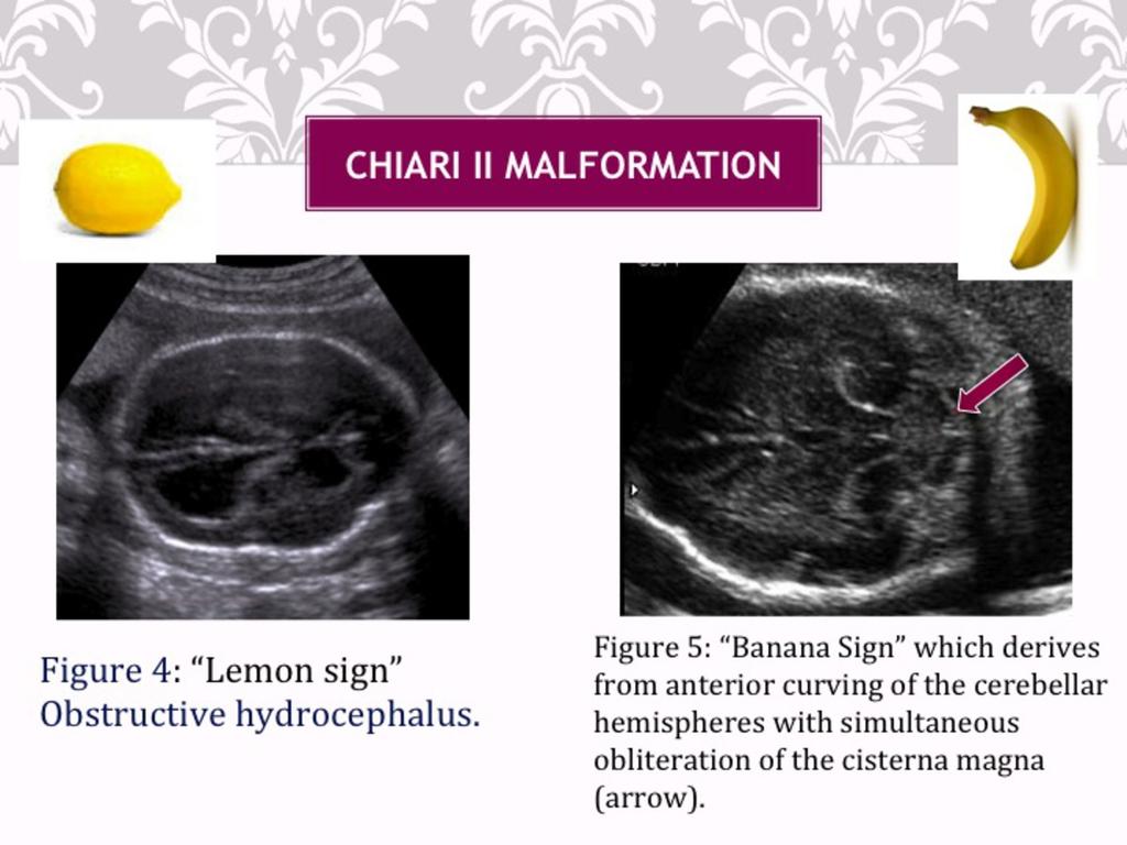 Fig. 10: Two ultrasound images showing