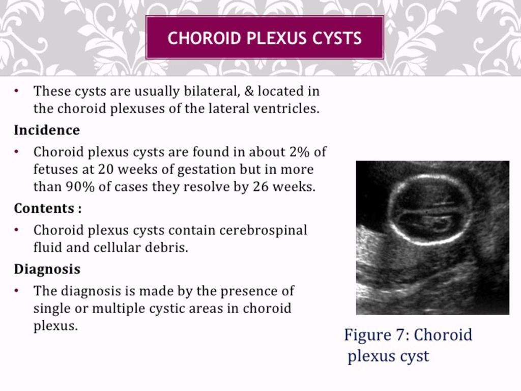 Fig. 12: Choroid