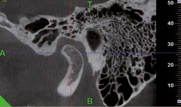 imaging A scan carried out with NewTom devices