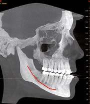 and that of the mandibular ramus, or information