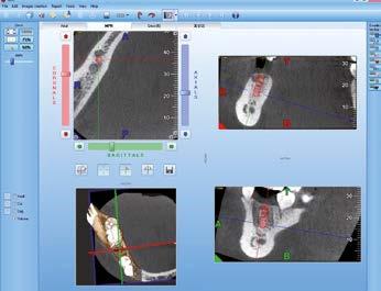 NNT: THE TECHNOLOGICAL CORE 2D and 3D analysis software NNT, designed entirely by