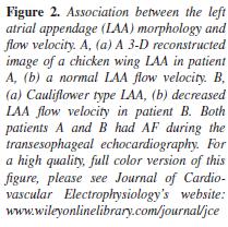 An Analysis of the Flow Velocity and Orifice Size of the Left Atrial Appendage.