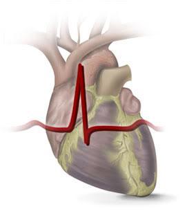 Acute coronary syndrome and/or PCI Current guidelines for ACS and/or PCI recommend ASA clopidogrel combination