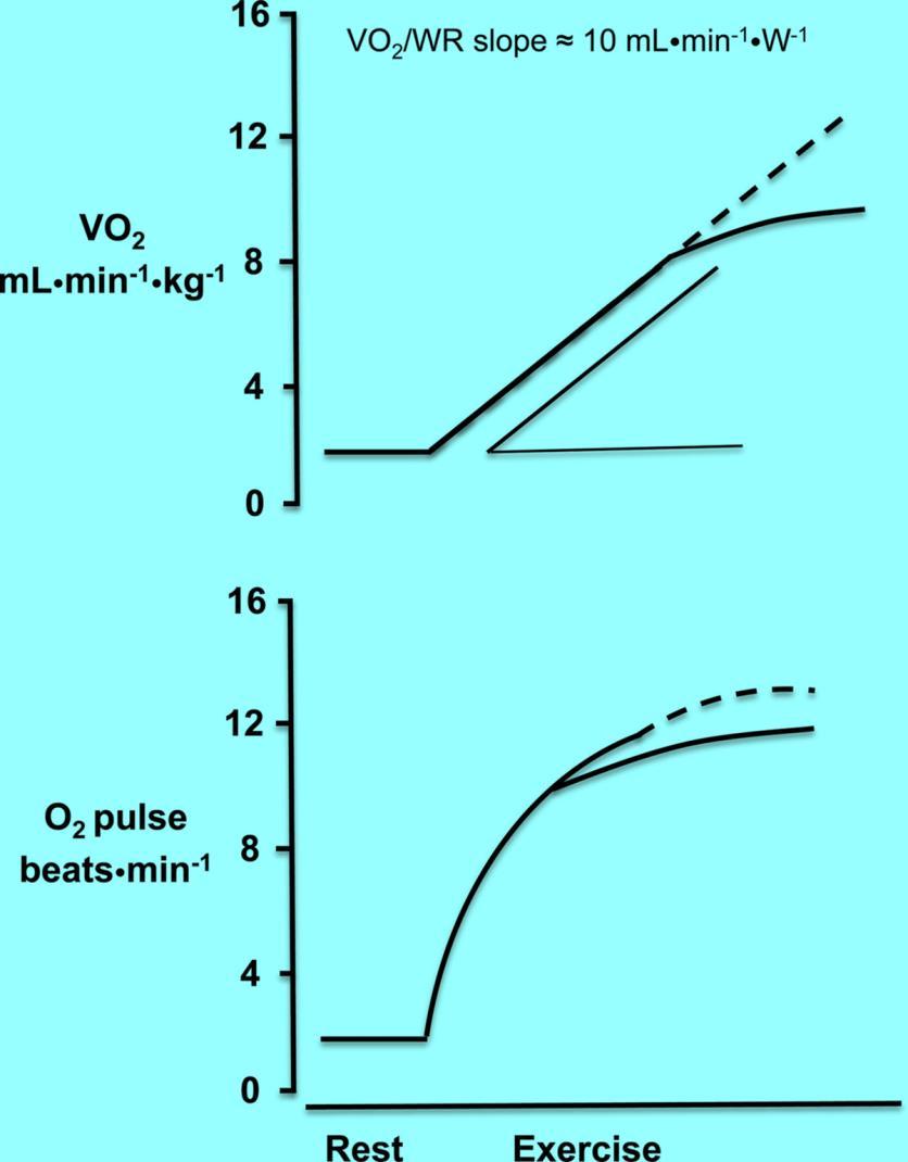 Normal (dashed line) and abnormal (solid line) example of oxygen pulse and ΔVo2/ΔW