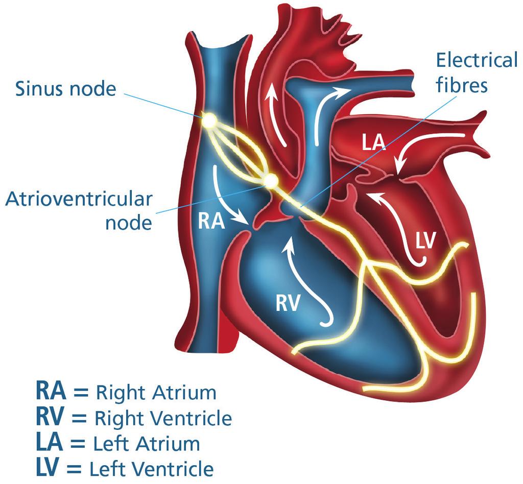 What is Atrial Fibrillation? Atrial fibrillation or AF is the name for the particular type of irregular heartbeat that you have. An irregular heartbeat is often called an arrhythmia.