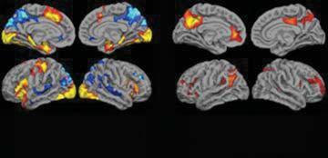 K.A. Johnson et al. fmri activity during memory encoding healthy young and older subjects suggest that fmri can detect acute pharmacological effects on memory networks (Thiel et al.