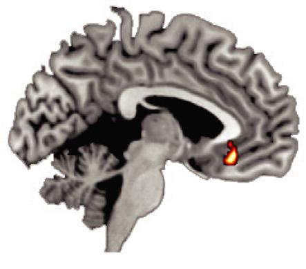 ) (C) Progressive decrease in retrieval-related hippocampal activity measuring using fmri for information learned before a nap, with intervening amount (min) of SWS demonstrating a significant