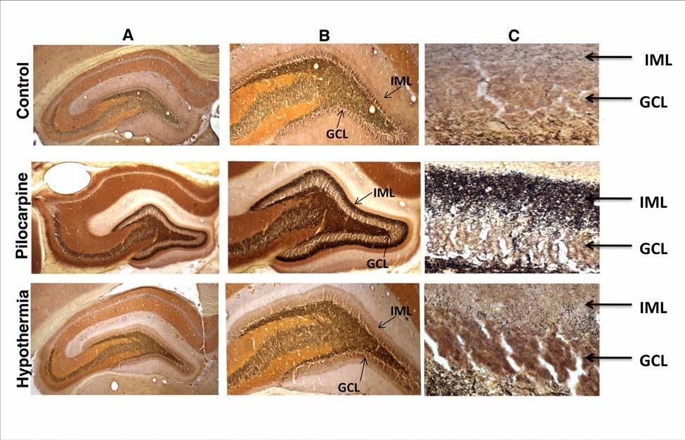 Figure 3-7. Timm stain images. Representative images of Timm staining in slices from control (top row), pilocarpine (middle row), and hypothermia rats (bottom row).