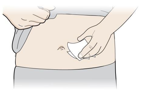 1 D Clean your injection site. Clean your injection site with an alcohol wipe.