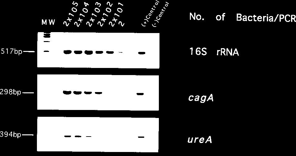VOL. 33, 1995 H. PYLORI caga EXPRESSION 29 TABLE 1.