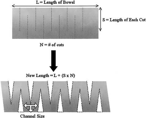 428 KIM ET AL Fig 4. Schematic of the STEP procedure. The formula for the theoretic new length of bowel is calculated based on measurement along one side of the lengthened bowel.