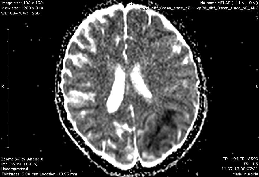 the brain tissue. Figure 4 C.