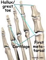 Like any other joint in the body, the joint is covered with articular cartilage, a slick, shiny covering on the end of the bone.