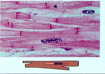 Cardiac MuscleCharacteristics Intercalated disks Cardiac muscle cells are faintly striated, branching cells, which connect by means of intercalated disks to form a functional network.