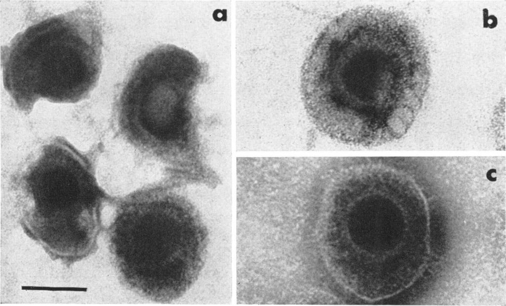VOL., 66 HUMAN CYTOMEGALOVIRUS a b 55 c FIG.. (a, b) Human cytomegalovirus (strain AD-6); enveloped forms stained with uranyl acetate. (c) Same as a and b but stained with phosphotungstic acid.