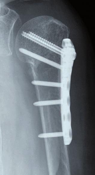 Technique 30 Sample Cases X ray