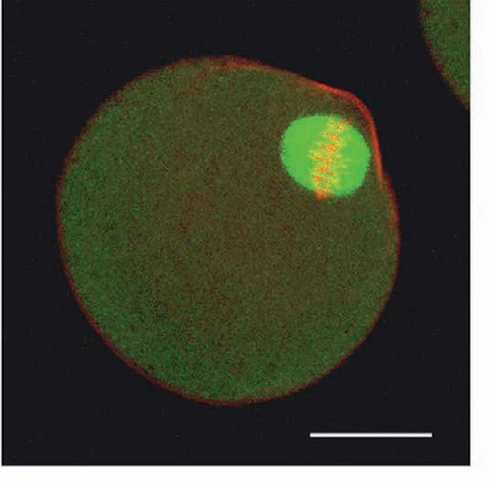 Figure 4. A confocal image of an manipulated oocyte (group D) that was fixed at presumed metaphase II stage and was immunostained for α-tubulin (green), actin (red), and chromosomes (red).