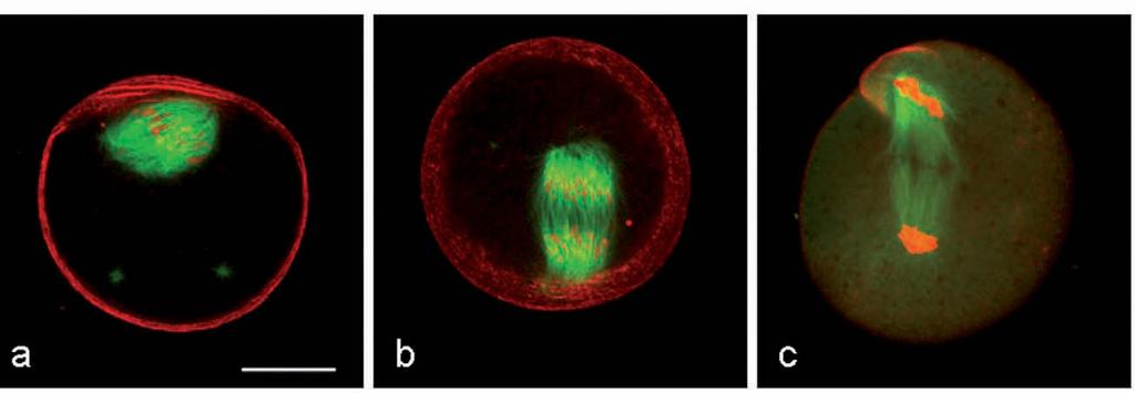 Confocal images of manipulated oocytes (group C; a, b, and c) collected and fixed during metaphase anaphase transition of meiosis I after 6 h of in-vitro maturation.
