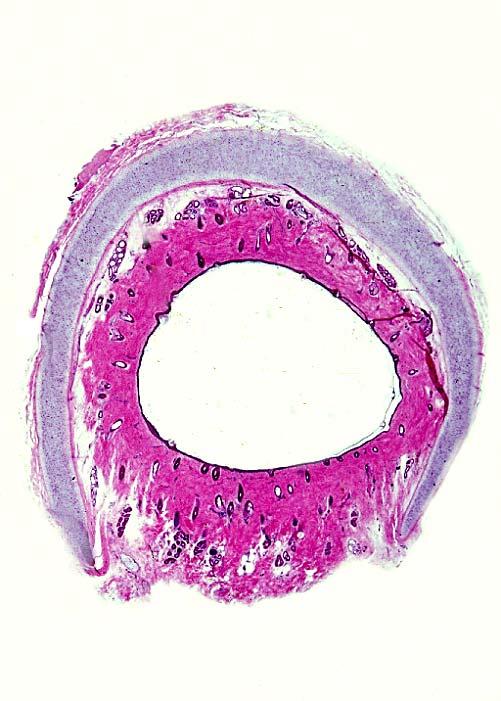 Gl. cerminosa Elastic cartilage Lumen Dermis 20-16 Tuba
