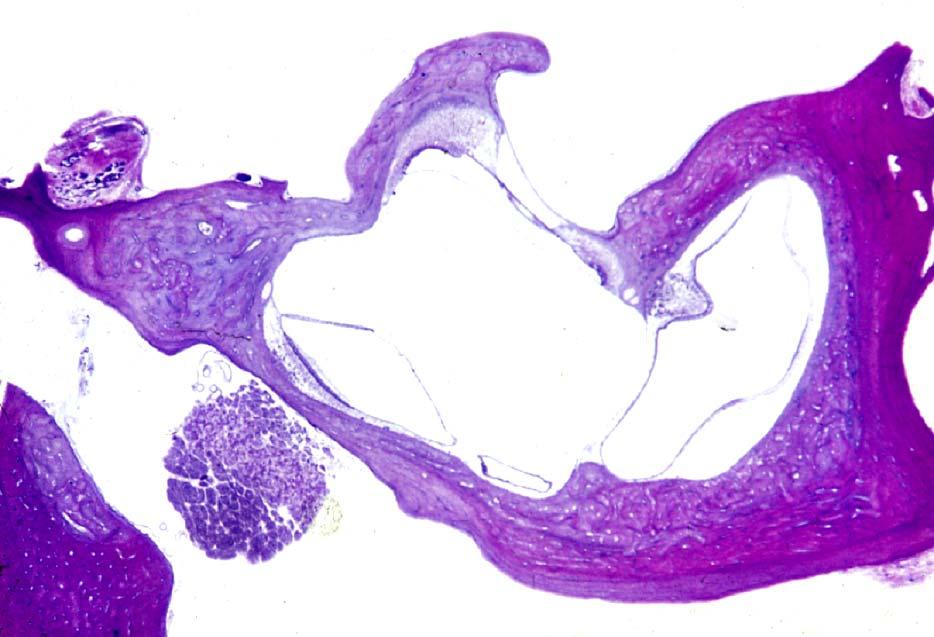 Macula sacculi Secondary tympanic membrane Round window Crista amp.