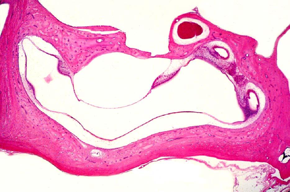 Vestibulum N. facialis Ampulla et crista amp. posterior Utriculus Base of crista ampullaris ant.