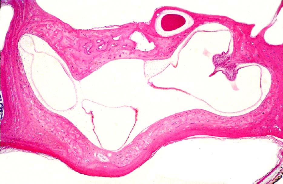 Vestibulum N. facialis Ampulla et crista amp. anterioris Ampulla posterior Ampulla et crista amp.