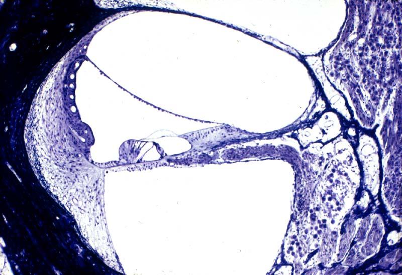Stria vascularis Vestibular membrane sv st Spiral ganglion dc Organ of Corti Spiral limbus ssl ssi Lamina basilaris Spiral ligament st