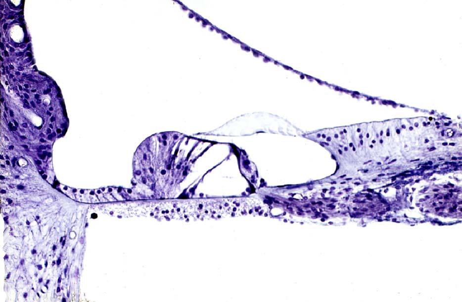 Stria vascularis Vestibular membrane sv dc Spiral prominence Organ of Corti Tectorial membrane Spiral limbus Cells of Hensen sse N ssi T Lig.