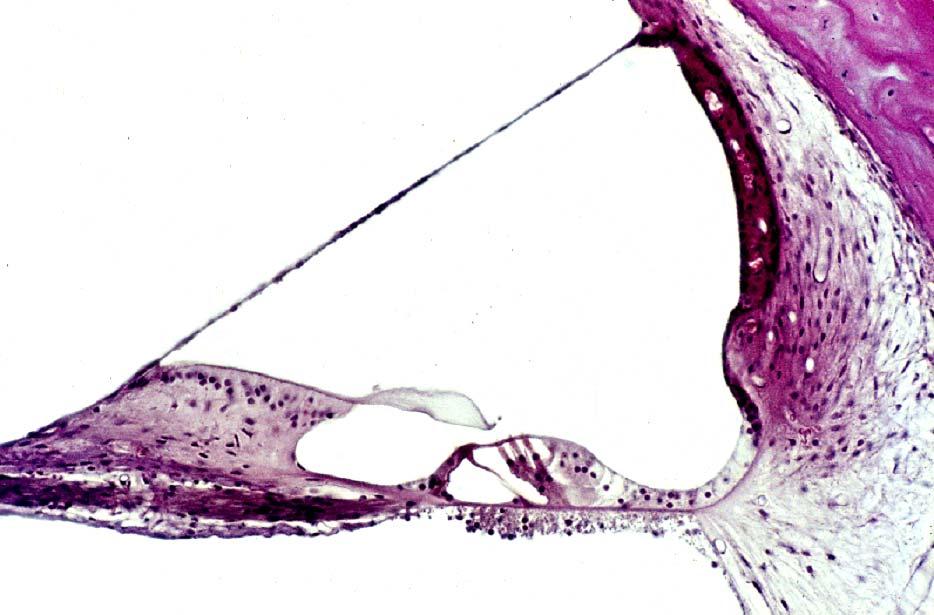 Vestibular membrane sv Stria vascularis Spiral limbus dc Tectorial membrane Spiral prominence Organ of Corti ssi sse Spiral