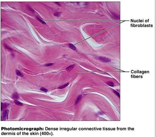 Dense irregular connective tissue consists of tightly packer collagen fibers that appear less organized and less uniform that dense regular connective tissue tissue.