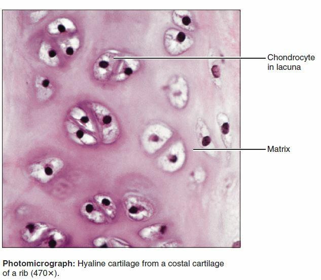 Hyaline cartilage is the most abundant type of cartilage found in our body. Your entire skeleton actually started out as hyaline cartilage when you were developing in the womb.