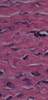 the fiber portion of the matrix of hyaline cartilage contains only thin fibrils of collagen that are too thin to be seen with a light microscope.