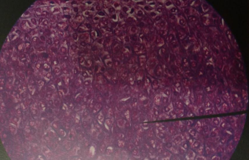 Elastic cartilage contains chondrocytes that are dispersed within a a threadlike network of elastic fibrers. Elastic cartilage functions to provides support. It also provides structure to the area.