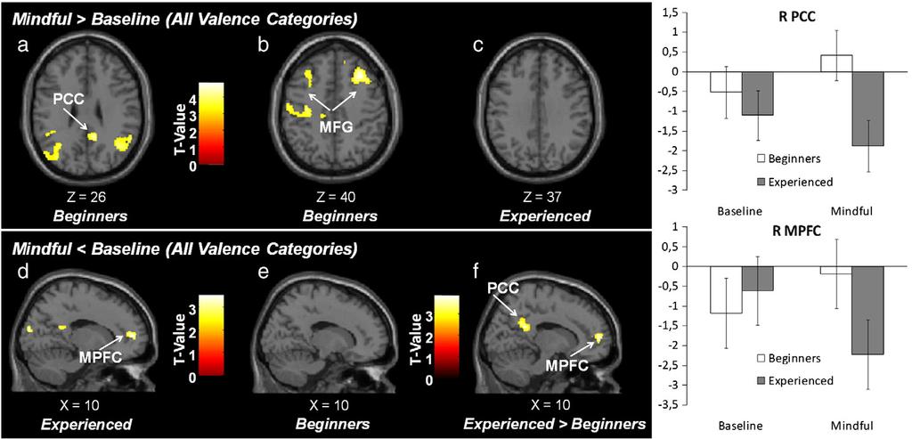 1530 V.A. Taylor et al. / NeuroImage 57 (2011) 1524 1533 Fig. 3. Statistical activation maps for the mindfulness-induced deactivations.