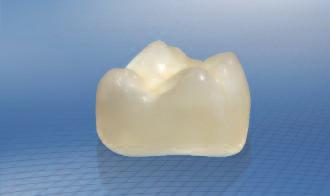 4 mm Marginal region, minimum wall thickness 0.2 mm Directions For Use Manufactured for: DENTSPLY International Inc.