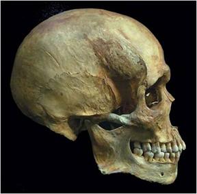 7. List the three common types of race determinations used by Forensic Anthropologists - African (Negroid); European (Caucasoid); Asian or Native Descent (Mongoloid) 8.