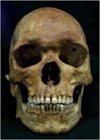 List three additional ways to identify skeletal remains - 1. Facial reconstruction using the skull; 2.