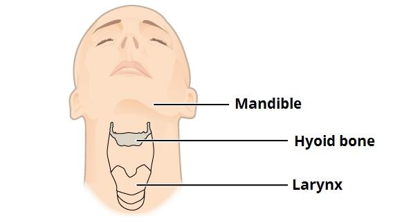 Hyoid Bone A small U-shaped bone suspended in the neck at the same level as the inferior edge of the mandible. In young individuals, it is composed of 3 segments which fuse later in life.
