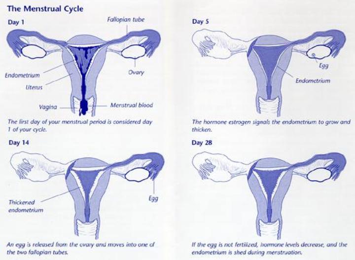Endometrial tissue outside the uterus responds to changes in hormones. It also breaks down and bleeds like the lining of the uterus during the menstrual cycle.