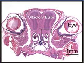Nerves lfactory Bulb
