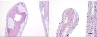 mg/m 3 ) LSCB (50 mg/m 3 ) Mucous Cell Metaplasia