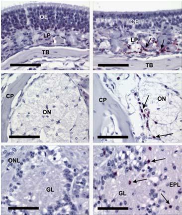 STG Induced Inflammatory Responses in Nose and Brain A C D Relative mrna Expression (Fold