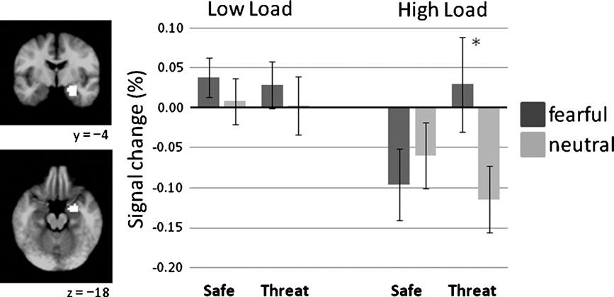 1366 B.R. Cornwell et al. / Neuropsychologia 49 (2011) 1363 1368 Fig. 2. Right amygdala ROI responses (N = 18) to face distractors during safety and threat of shock on low and high load trials.
