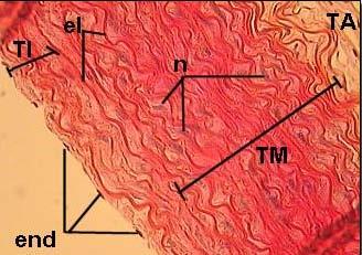 Aorta el = elastic fibers end = endothelial cells n = smooth muscle