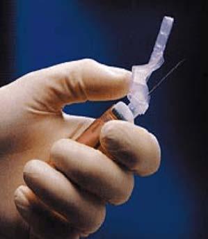 Completing the Venipuncture- Always release tourniquet and remove the tube from the