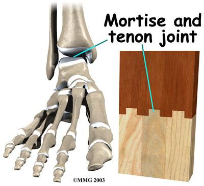 Woodworkers and craftsmen are familiar with the design of the ankle joint. They use a similar construction, called a mortise and tenon, to create stable structures.