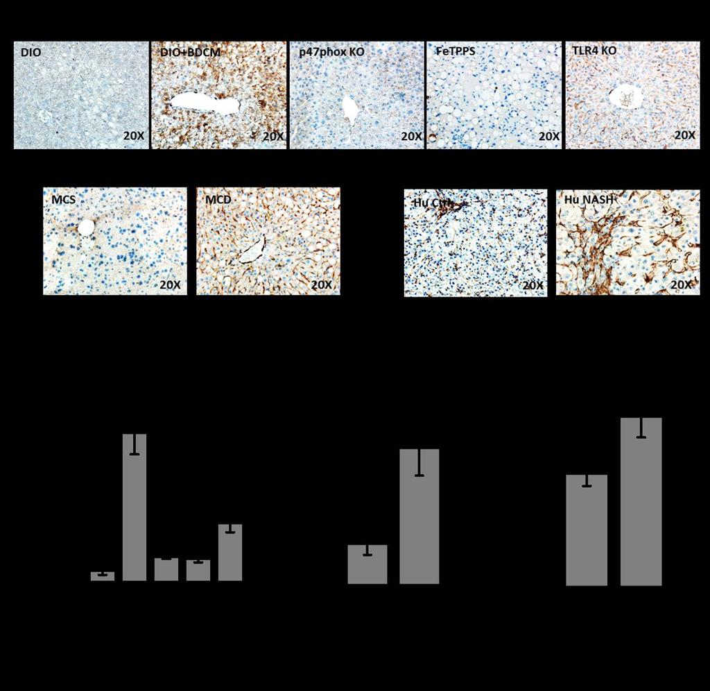 Figure 4.6 A-C: Immunohistochemistry images for ɑ-sma in rodent NASH models and human samples.
