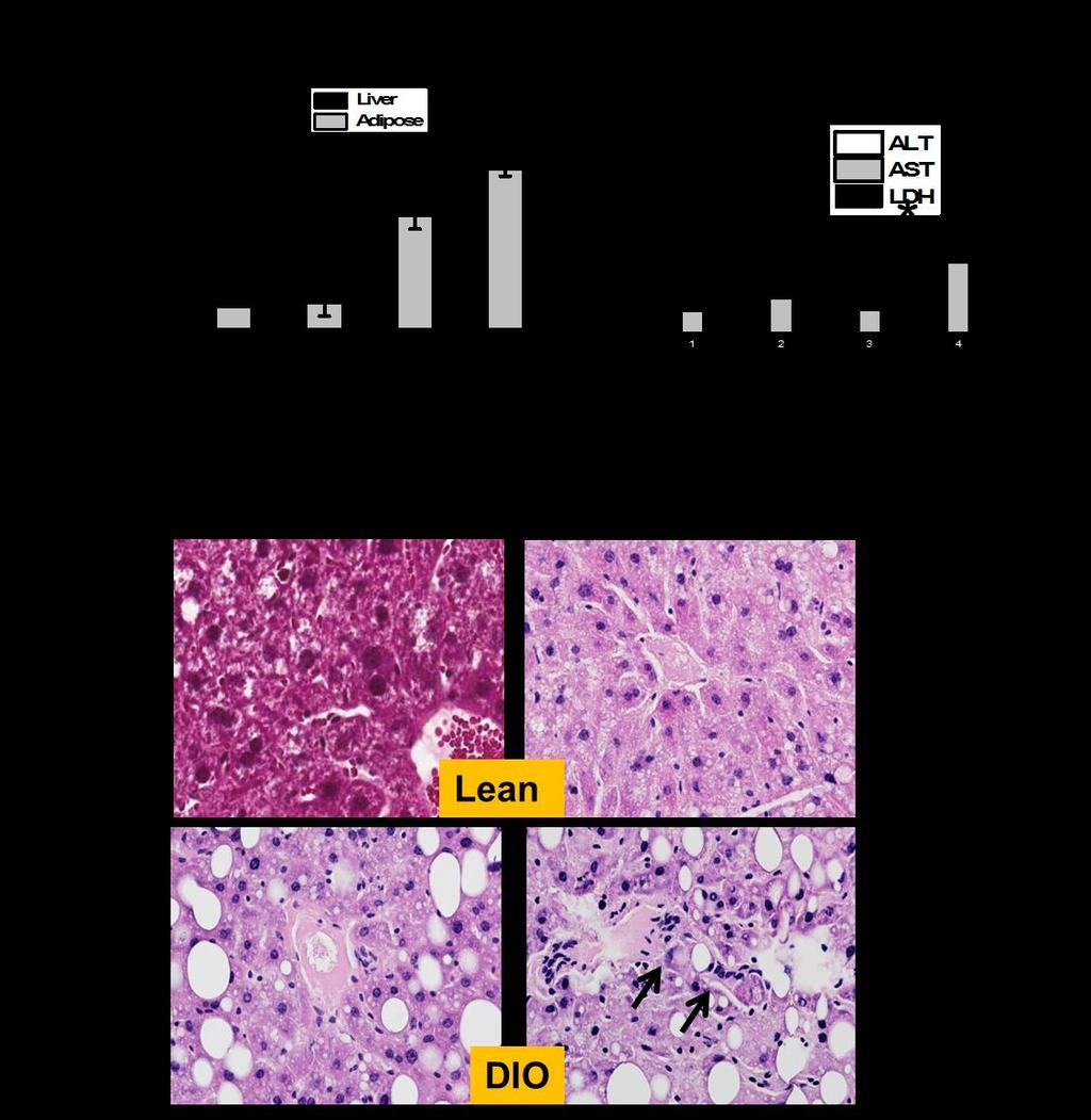 Figure 2.2 Diet induced obesity and BDCM co-exposure increases leptin expression and contribute to early steatohepatitic lesions. A.