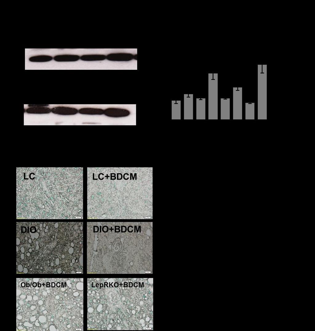 Figure 2.5 BDCM and leptin mediated cell death mechanisms in diet induced obese liver. A. Western blot analysis of isocitrate dehydrogenase, a hepatocyte necrosis marker in liver homogenates.