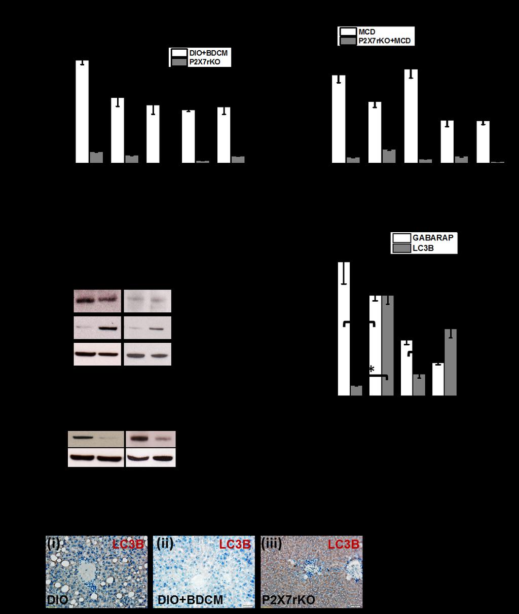 Figure 3.4 P2X7 receptor deletion modulates autophagy in NASH. A and B.